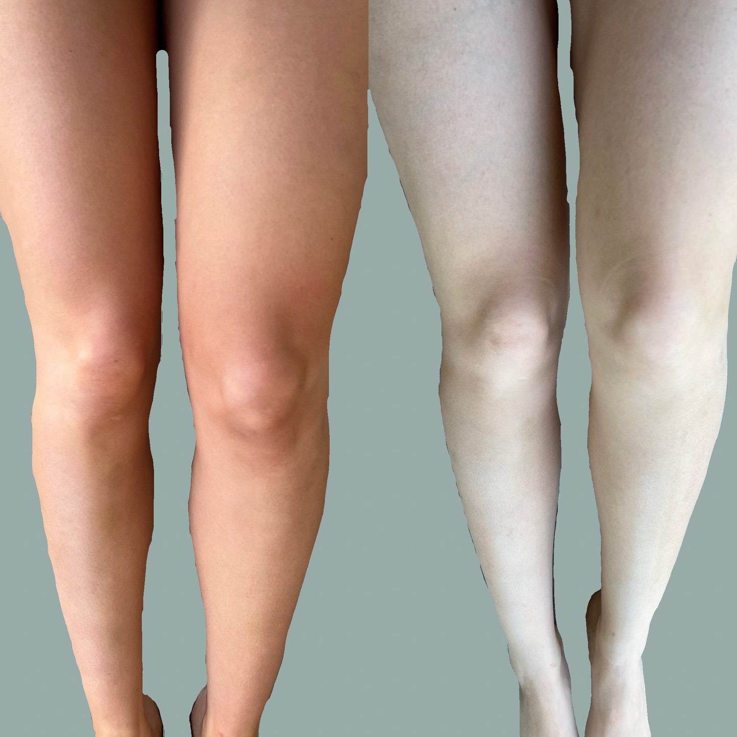You Bronze Self Tanning Mousse